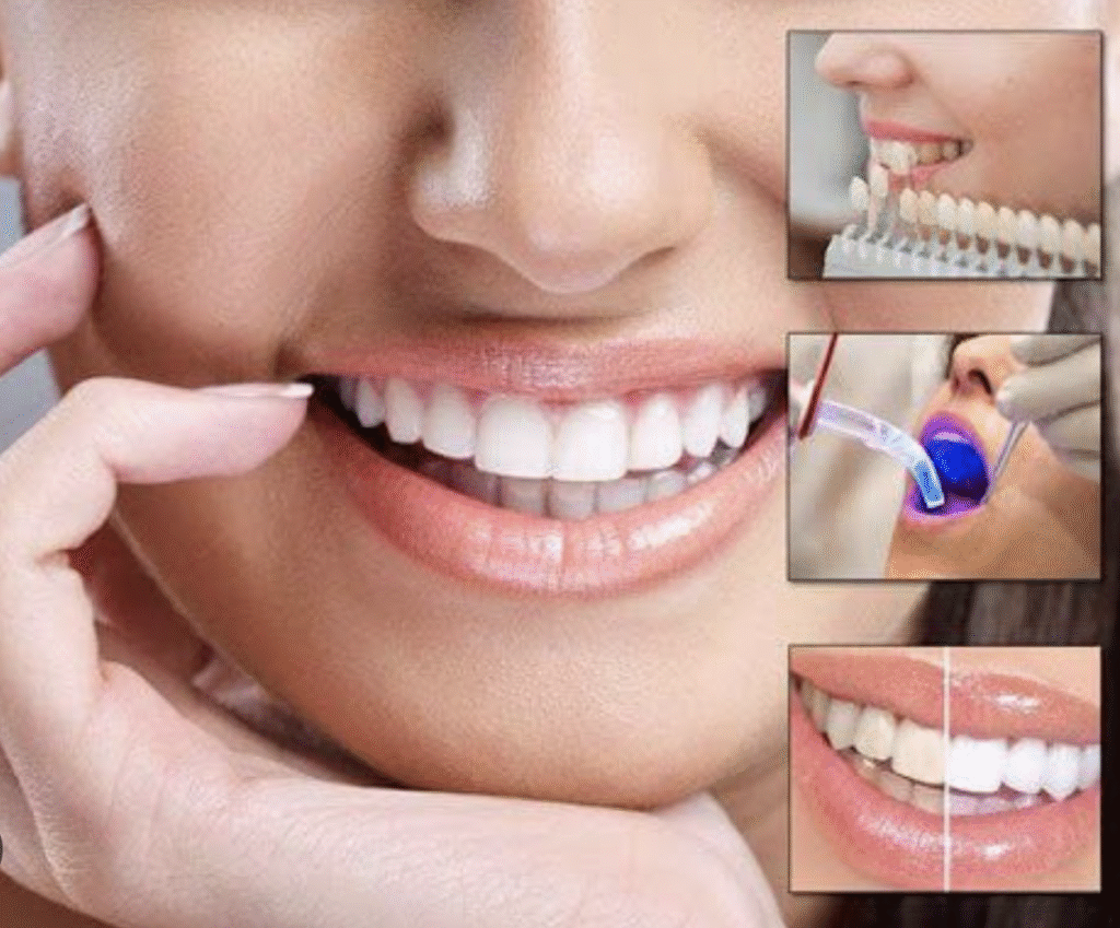 Full mouth restoration procedure at Grayson dental office
